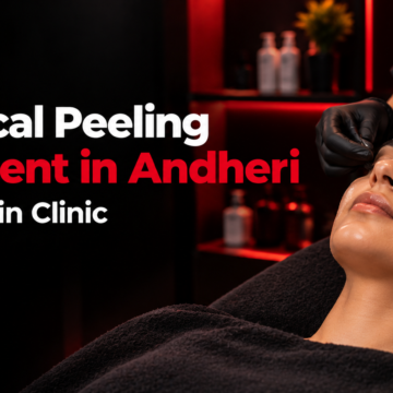 Chemical Peeling Treatment in Andheri