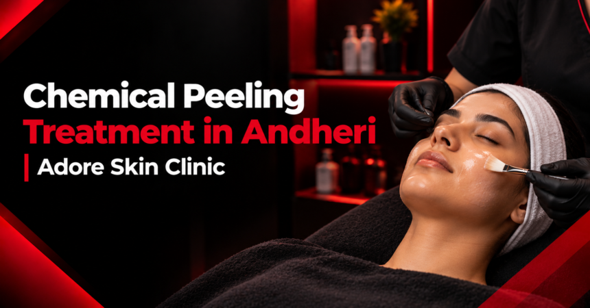 Chemical Peeling Treatment in Andheri Chemical Peeling Treatment in Andheri