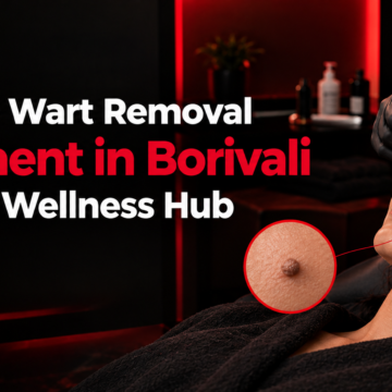 Wart Removal Treatment in Borivali