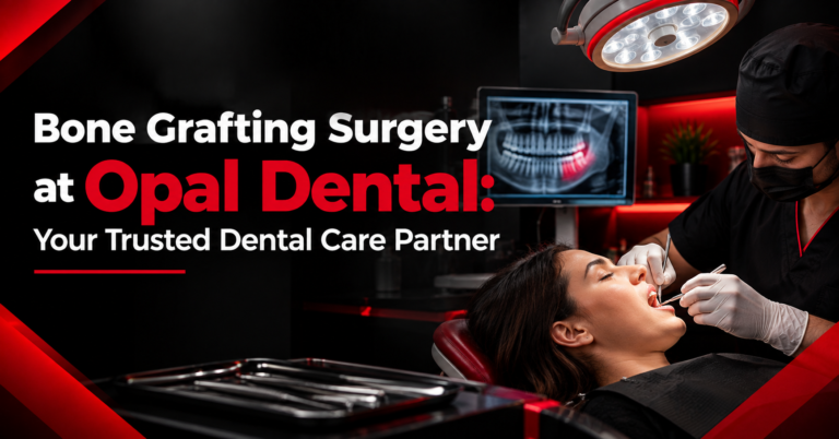 Bone Grafting Surgery at Opal Dental: Your Trusted Dental Care Partner